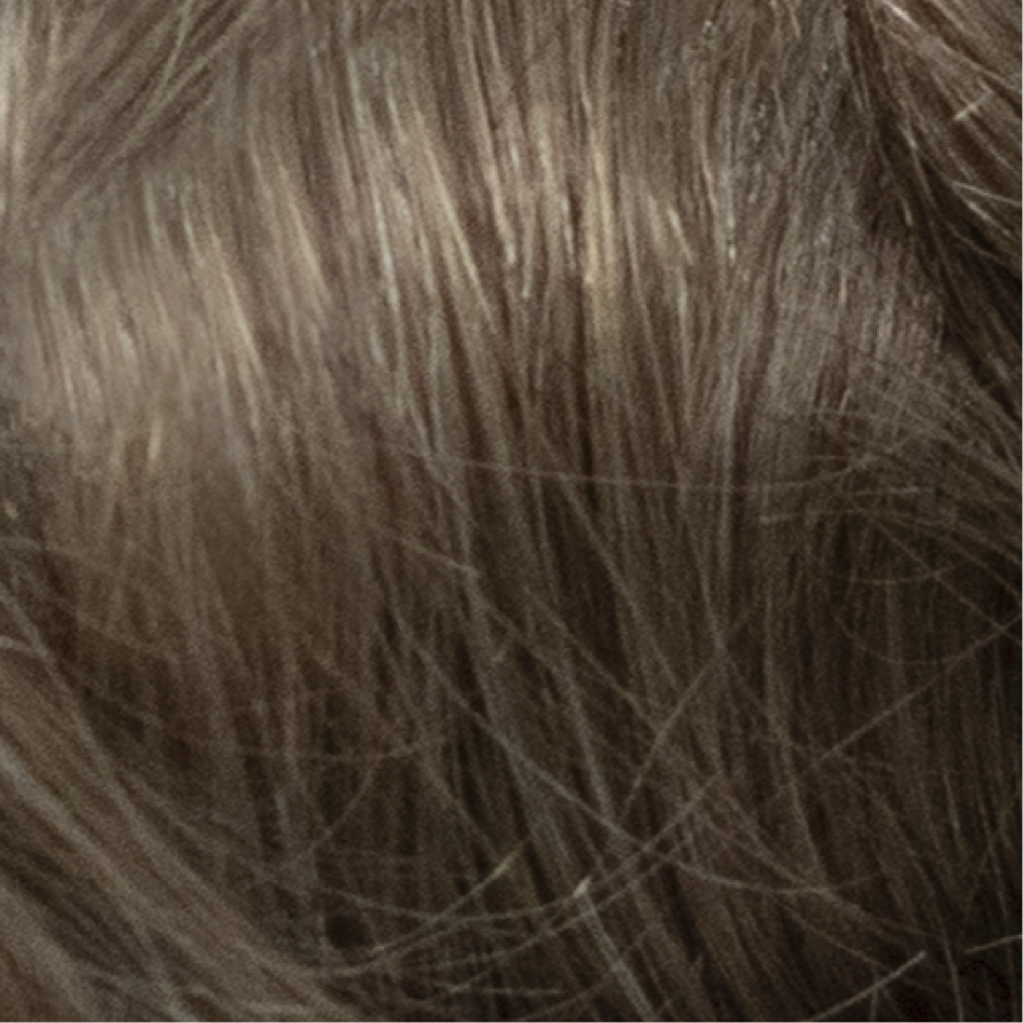 Dermis Pro 1 | Fine Mono with Skin front