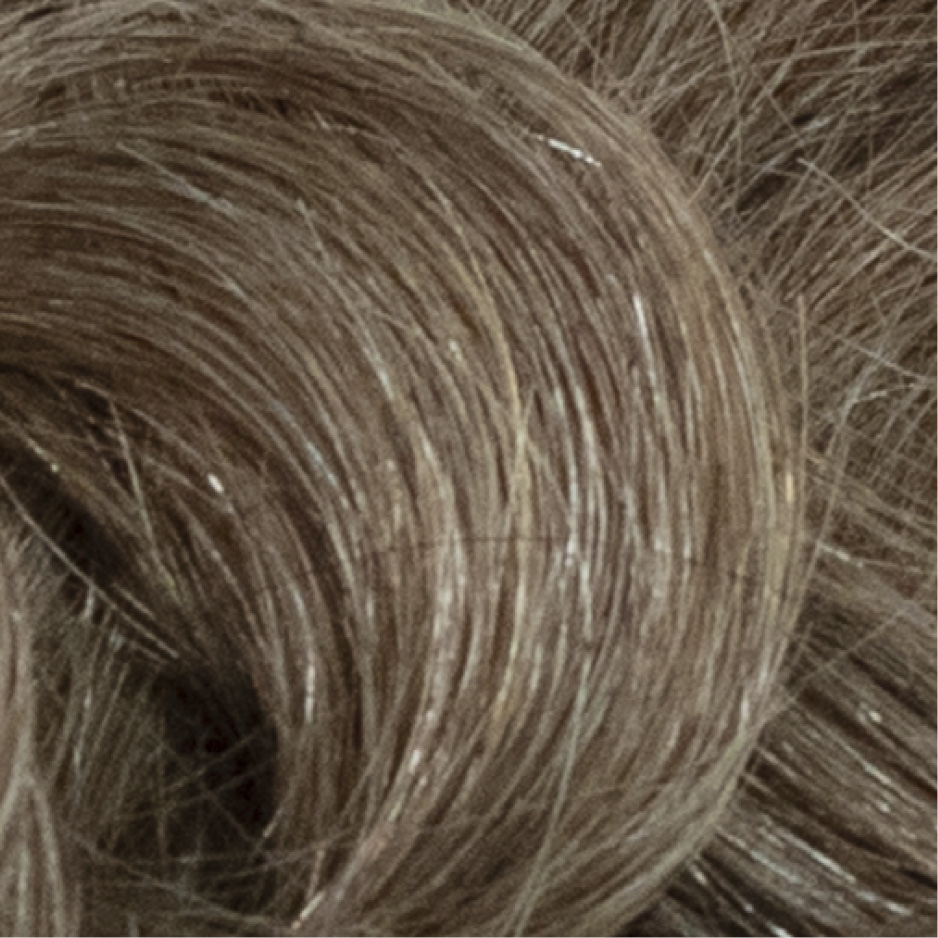 Dermis Pro 1 | Fine Mono with Skin front