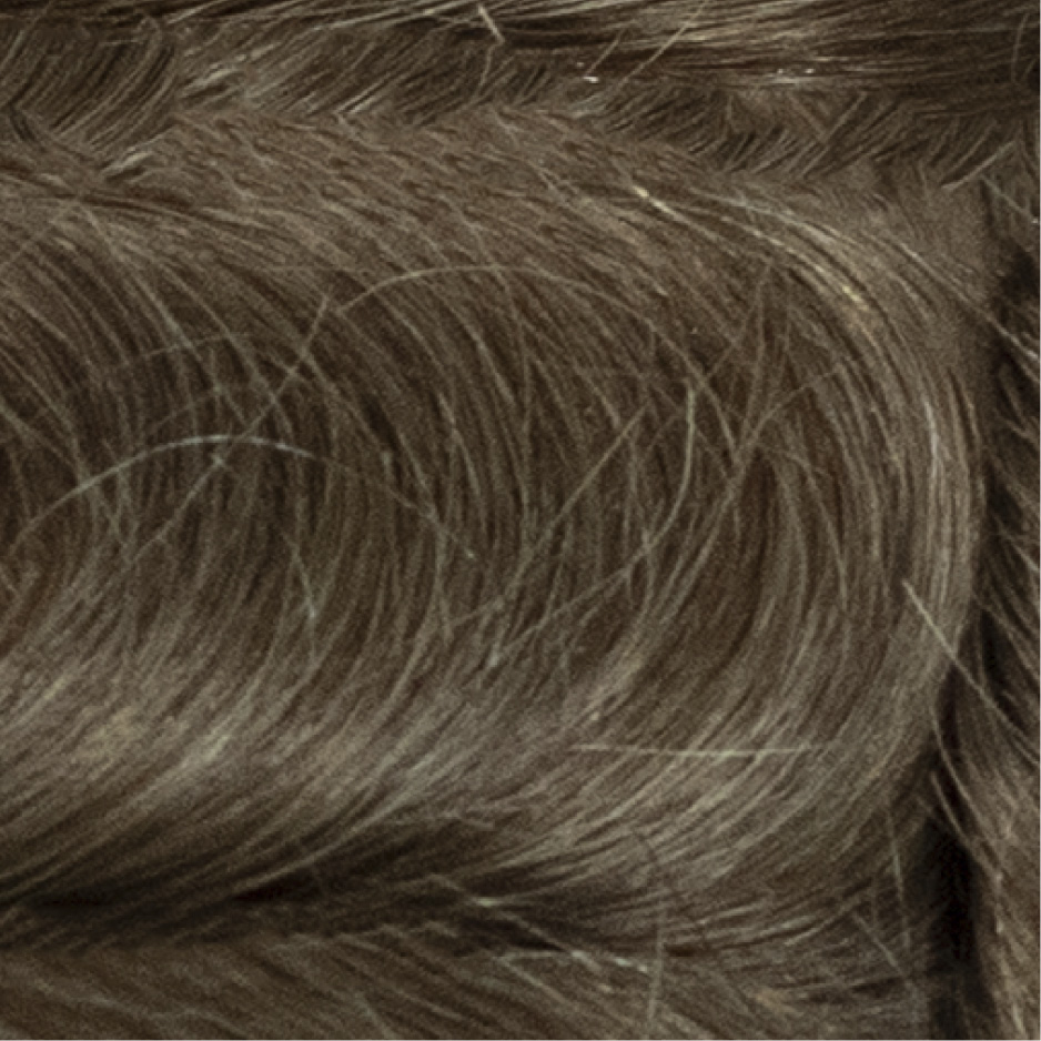 Dermis Pro 1 | Fine Mono with Skin front