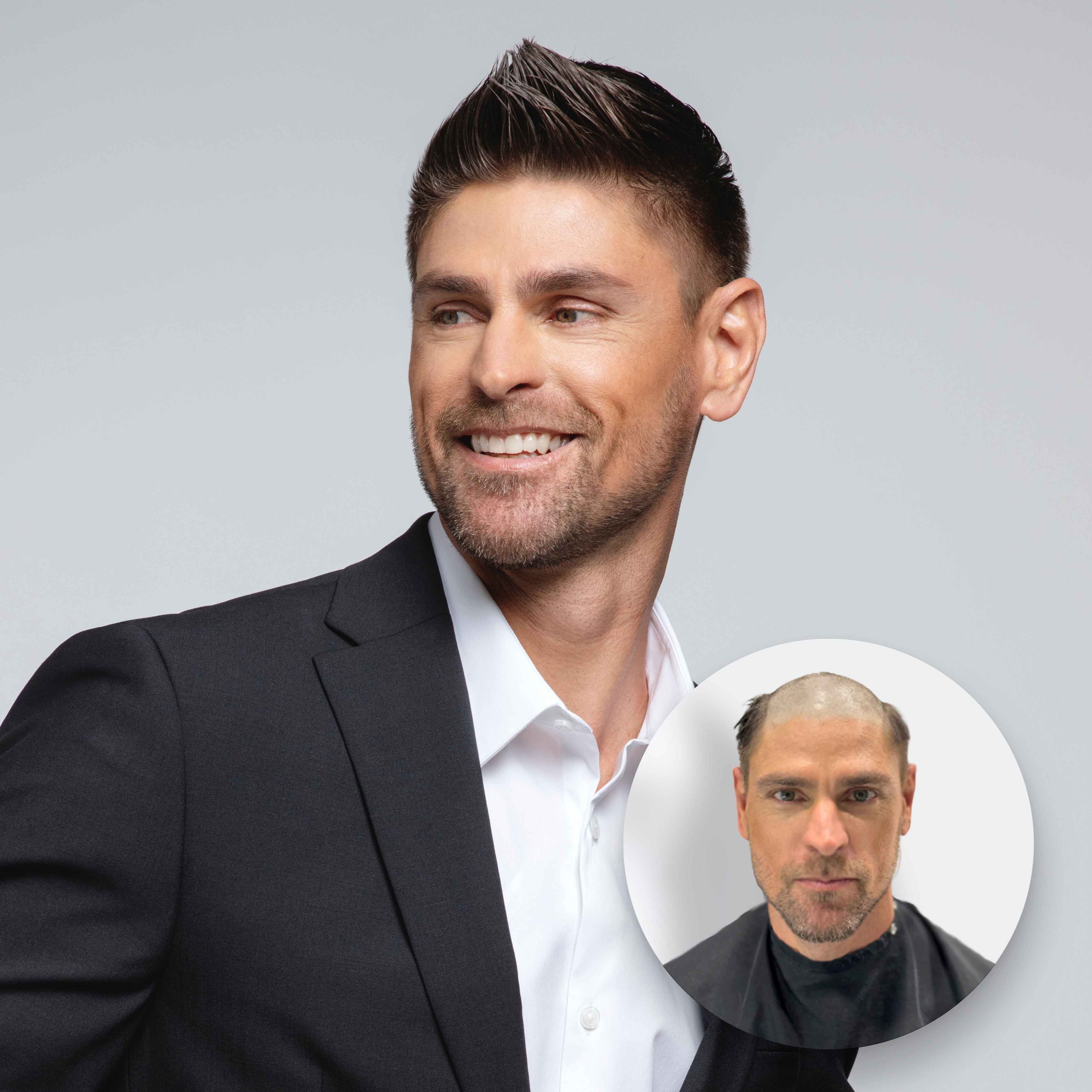 Vita Lace | Super Fine Mono