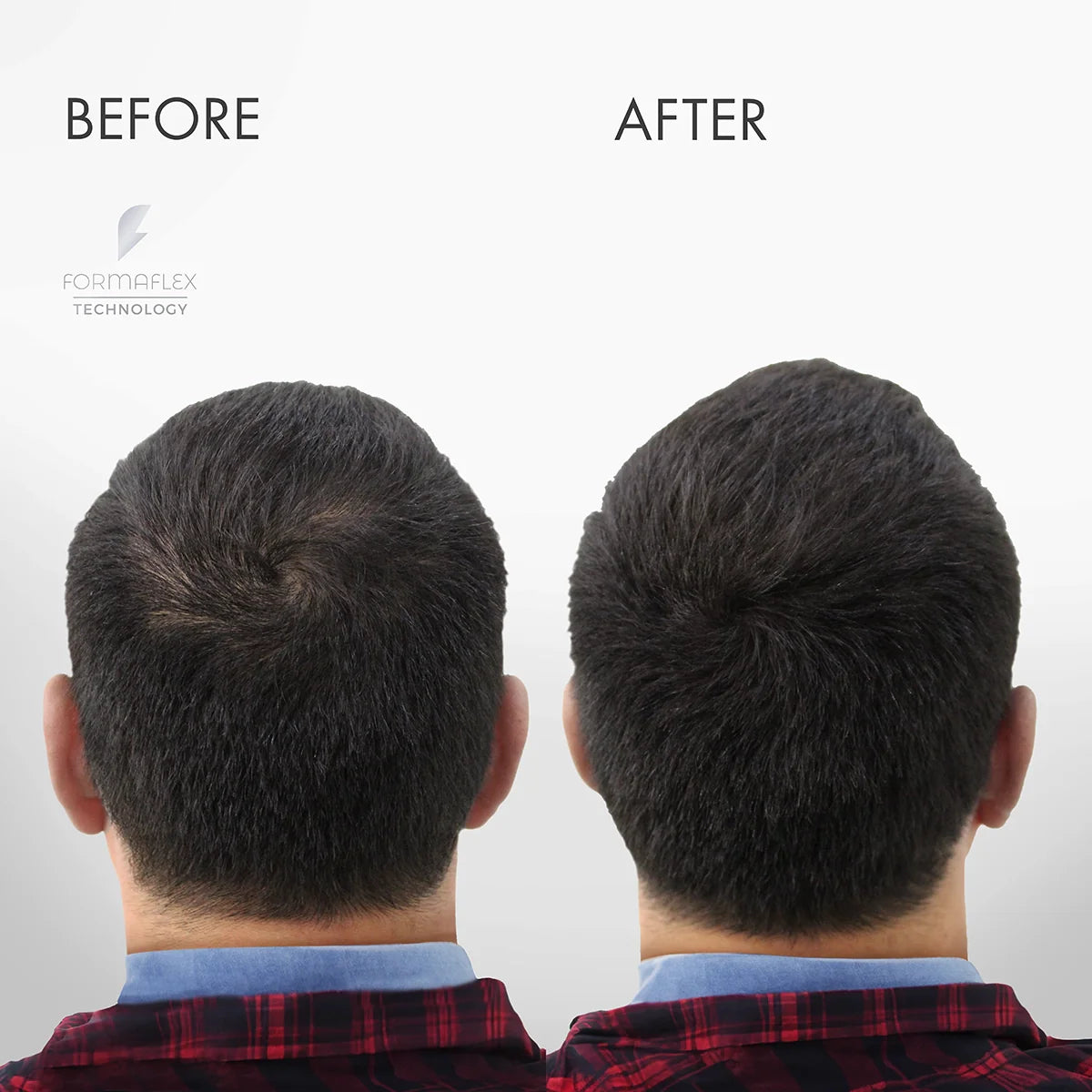 Hair Loss Concealing Kit