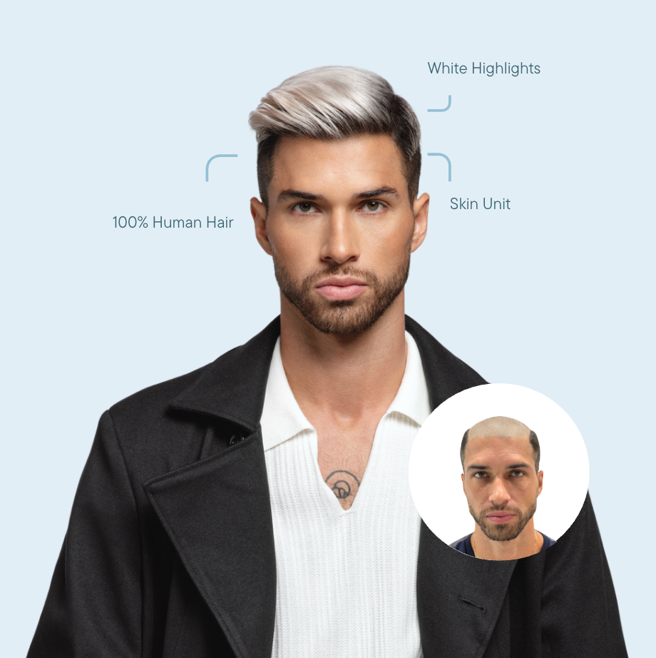 Understanding Hair Thinning and Hair Loss After COVID, Diabetes, and Weight Loss — And How Wigs Can Help