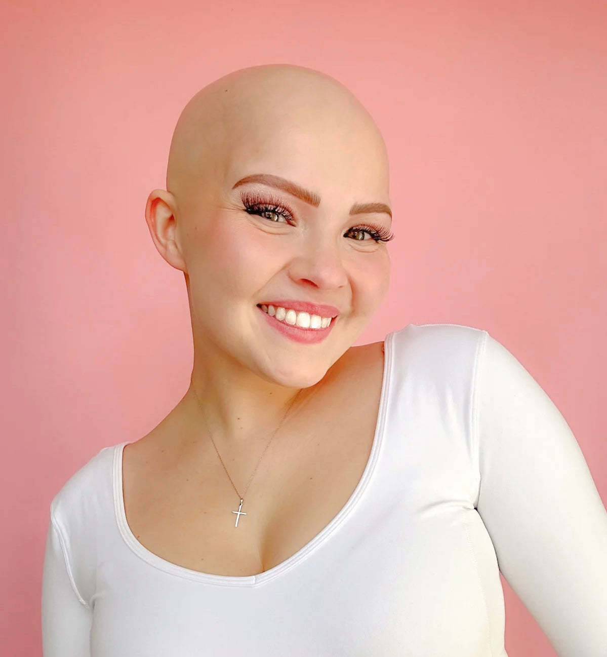Living with Alopecia: Questions Often Heard