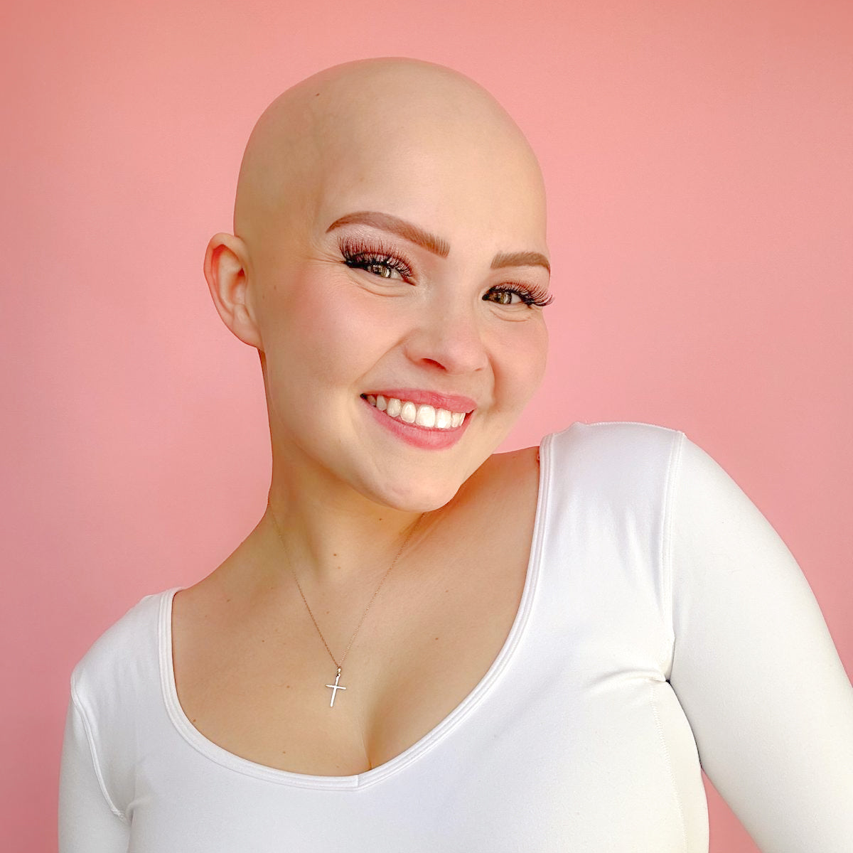 Alopecia Awareness Month: Your Questions Answered