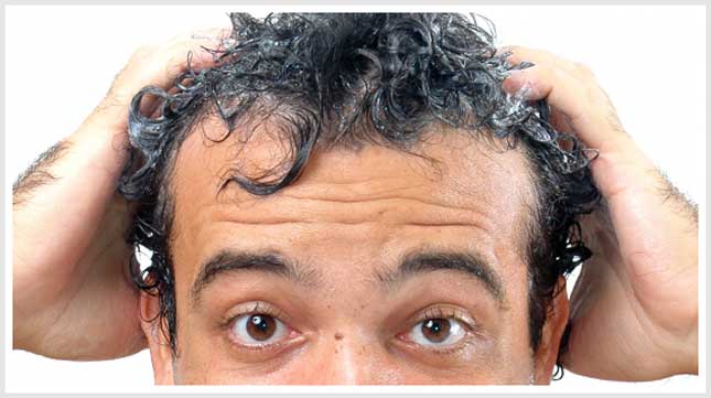 minoxidil - Minoxidil (Rogaine): An FDA-Approved Hair Loss Treatment